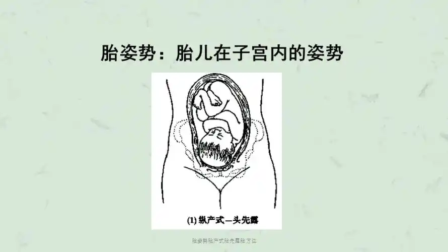 胎姿势胎产式胎先露胎方位课件