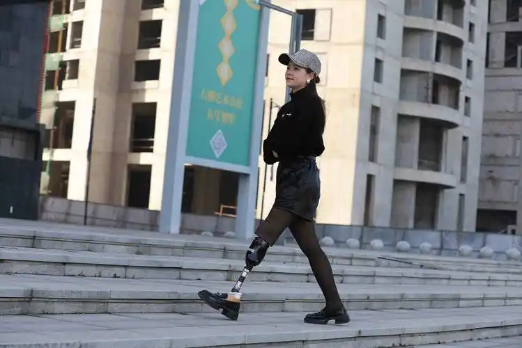 接受腔的碳纤维复合材料能很好地承担起人体的重量,并能有效控制假肢