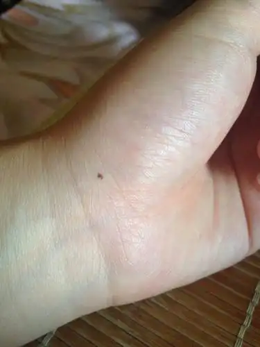 谁能说说这手上两个痣代表什么