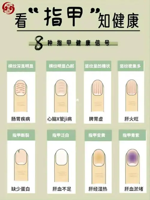 看"指甲"知健康!