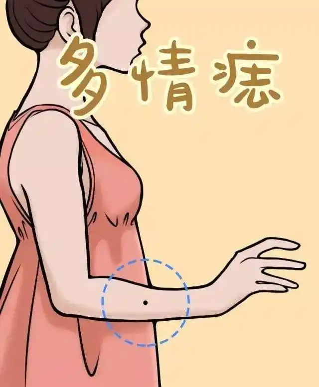 女人右手臂有痣预示哪些命运,你的手臂有没有?