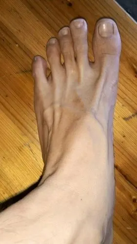 我是男生 为什么我的脚那么瘦 骨头和血管都露的很