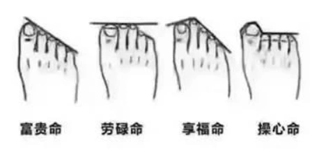 从脚趾长短看命运,"富贵""贫穷"一看便知,你是哪一种?