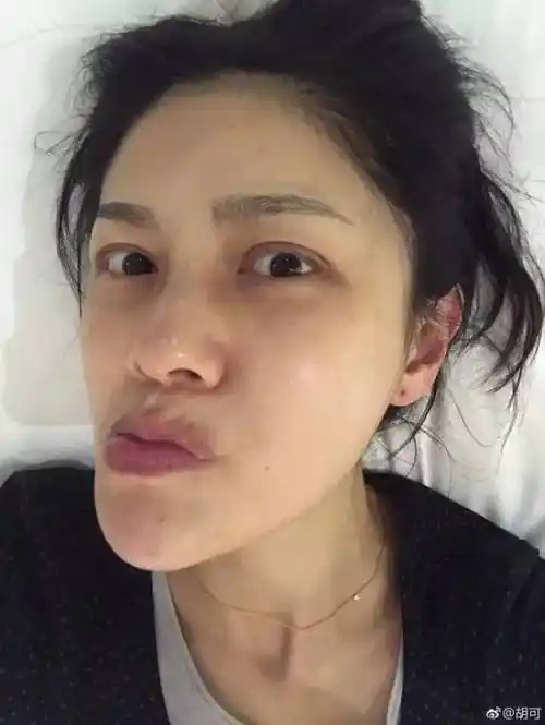 胡可五官变形陈意涵双眼皮吓人舒淇满脸雀斑女星们为爆素颜这么豁得