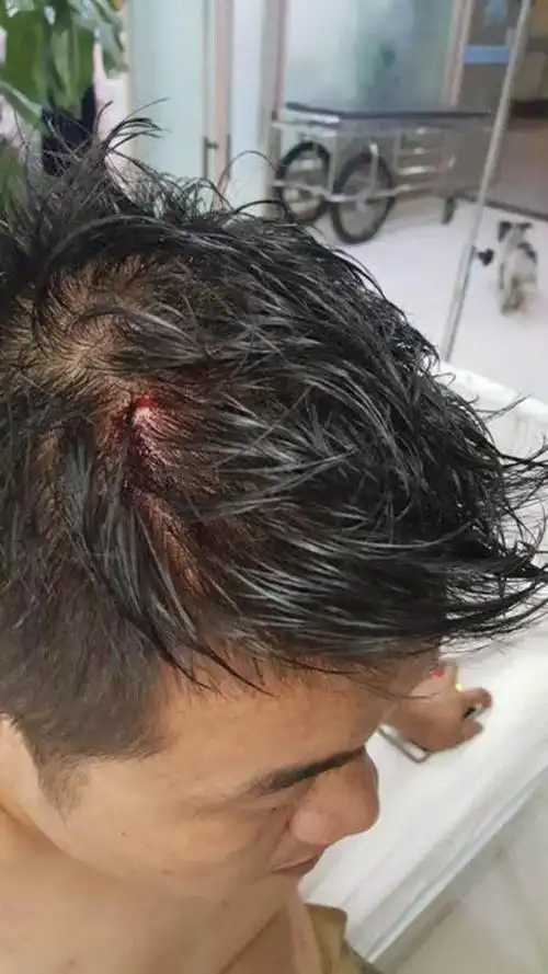 网曝陕西一官员娱乐场所带走卖酒女打伤经理,纪检部门调查