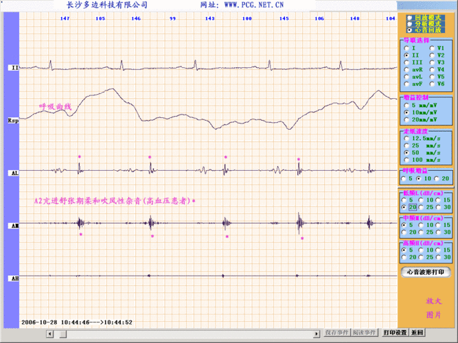第二心音的简介