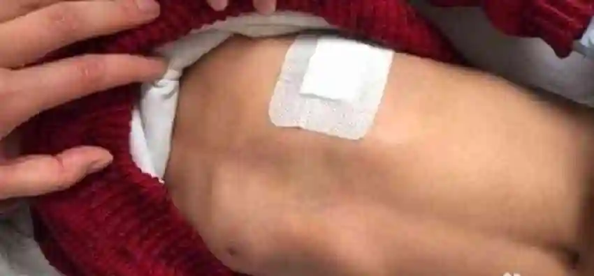 鸡胸宝宝平躺是什么样的有真实图片参考吗