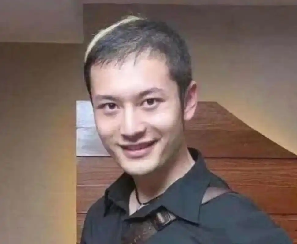 黄晓明多年前的照片中,已经能够看出他的头发开始稀疏.