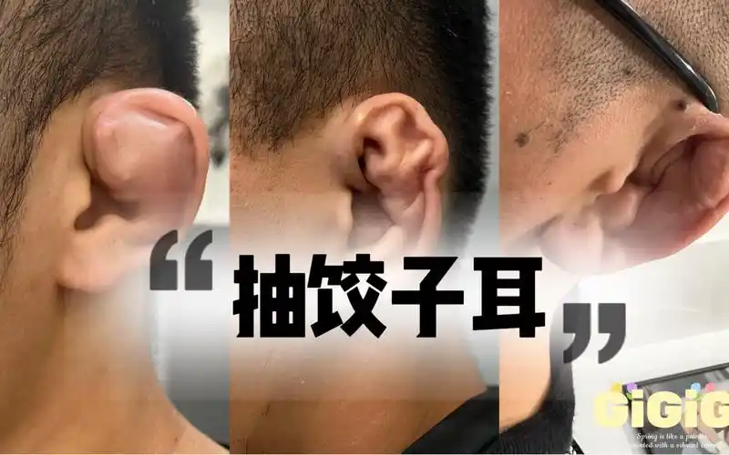 如何处理饺子耳