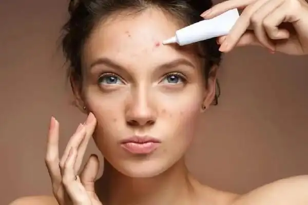 积玉桥俏佳人美容形象会所痘痘肌清理怎么样 痘痘肌肤适合用什么洗面