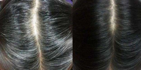 30岁就开始白头?洗头发加点"小东西",轻松白发变黑发,还柔顺