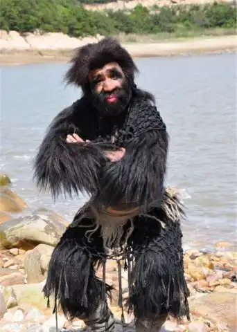 "中国第一毛孩"出生就被研究,身体96%覆盖黑毛,42岁终遇真爱_腾讯新闻