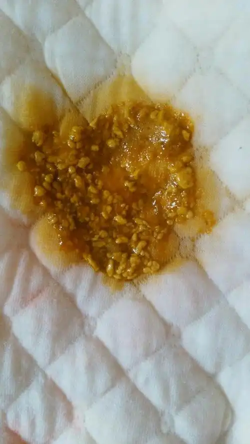 求解,宝宝便便有奶瓣