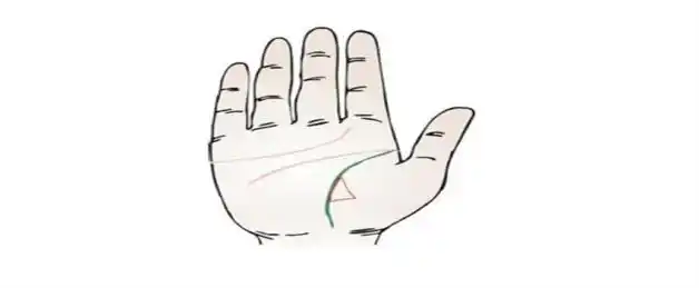 详解:生命线上出现三角纹路(三角纹位于生命线,生命线和三角纹重叠