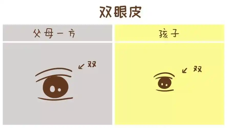 双眼皮也是显性遗传,例如单眼皮与双眼皮的人结婚,孩子极有可能是双