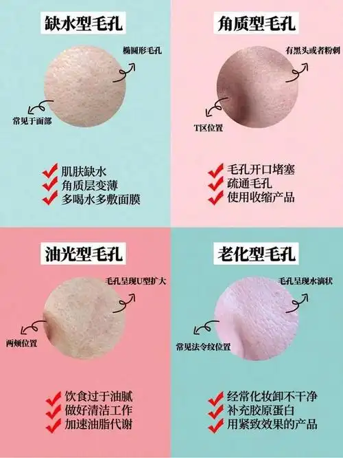 想要修复粗大毛孔,首先你必须要了解毛孔的类型和形成哦