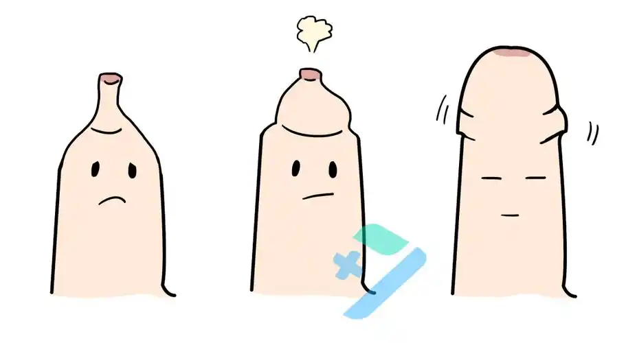 男娃包茎,包皮过长,不及时处理,真的很危险!_龟头_割包皮_阴茎