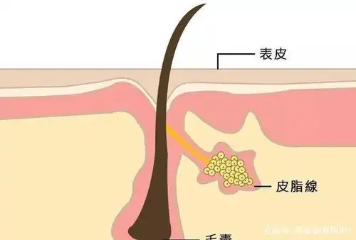 皮肤粗糙,毛孔粗大,我列出了原因,也附上了解决办法,自制