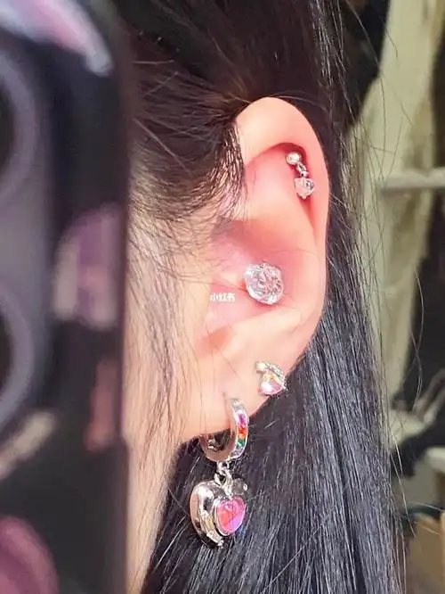 答应我反骨耳要去打耳蜗好吗