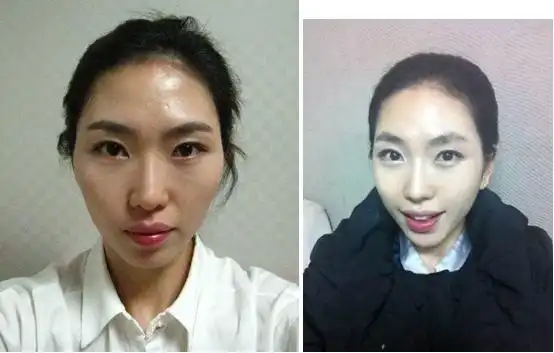 颧骨塌陷代表运势不好?-周易易学讲堂-面相研究