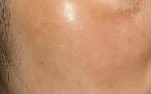 情绪差,脸色暗沉,中医这样改善