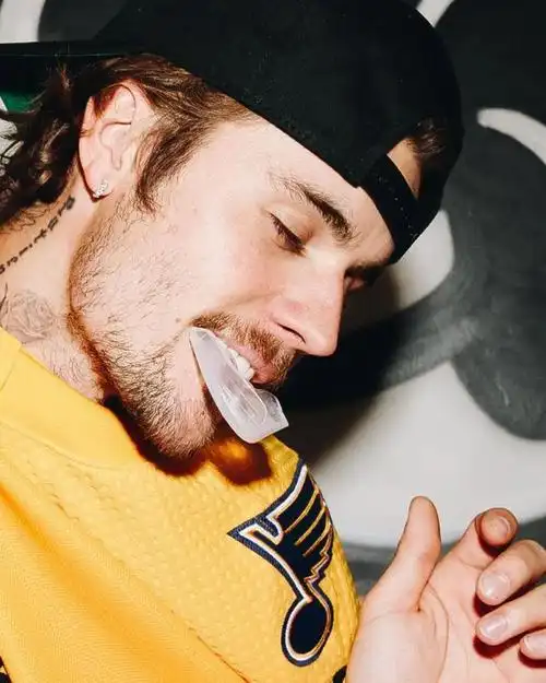 justinbieber回归舞台病好了精神抖擞