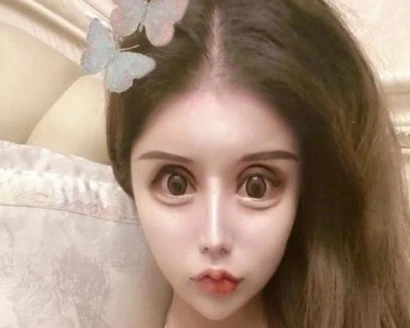 网红女孩13岁开始整容 现在的容貌令人唏嘘
