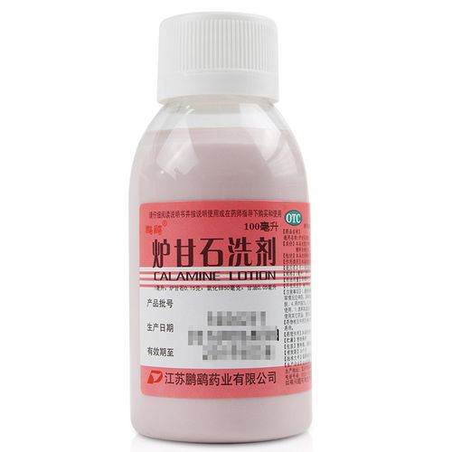 鹏鹞 炉甘石洗剂 100ml 湿疹止痒荨麻疹皮肤病外用洗剂