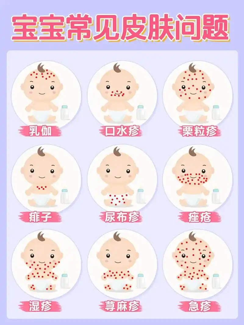 新手妈妈 宝宝常见皮肤问题及护理方法,准爸妈赶紧收藏.#育 - 抖音