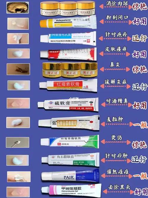 盐酸金霉素眼膏:脂肪粒