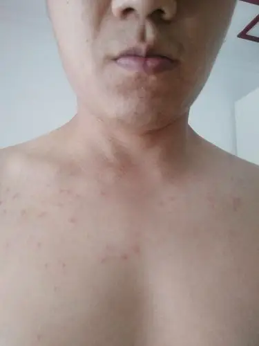 身上起了小红点请帮我看看