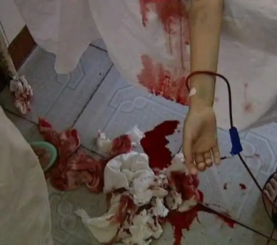 小苏丽验尸照片(死后遭亲生母亲扒坟)