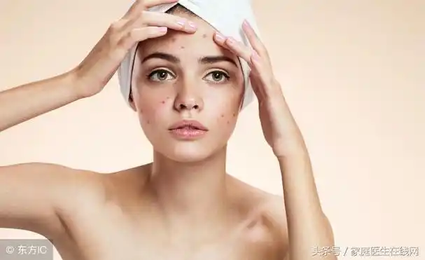 皮肤不好长痘怎么调理最快最有效(这3个小秘诀避免皮肤长痘)(2)