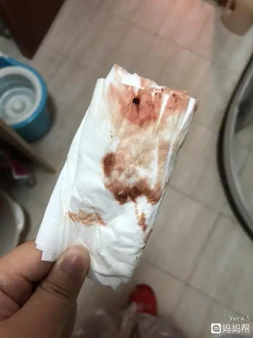 优先孕!着床成功后出血图片"称为母亲"-第1张图片-宝临网