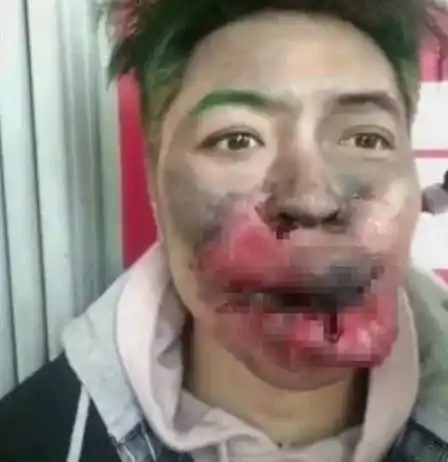 很多路人看着男子的嘴巴,都说打人的男子太过分,把人打成这样可怎么见