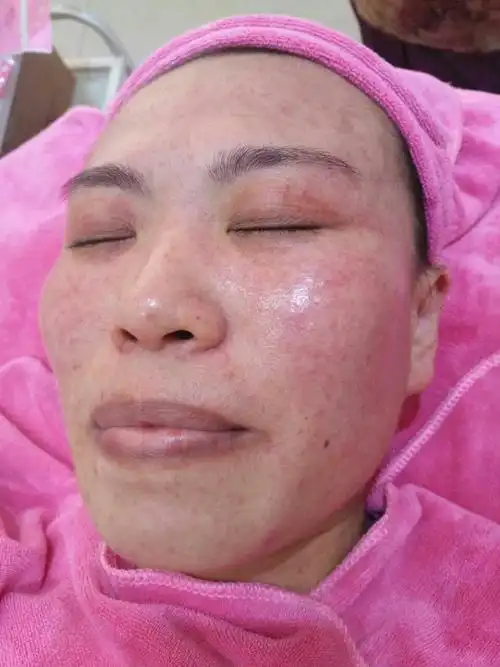 希望在我不断努力的过程中,所有问题性皮肤都可以得到修复