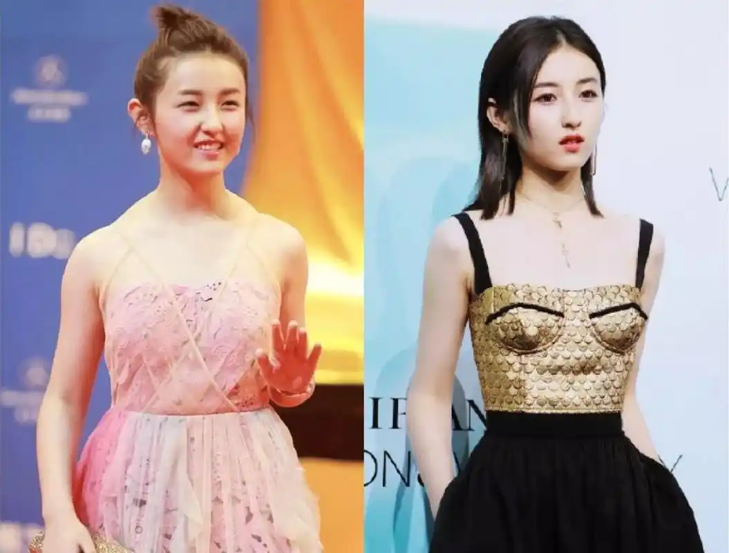 解决斜方肌再来个周冬雨套餐张子枫脱胎换骨的美貌终于出来了