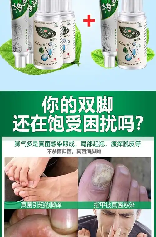 脚痒王喷剂 脚气真菌克星脚臭脱皮干脚裂正品去死皮杀菌止痒_闺蜜优惠