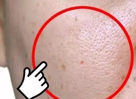 3 跟吸尘机一样强劲的去角质产品,除非你的角质层已经跟城墙一样厚了