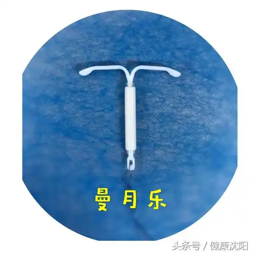 各种节育环的种类图片介绍(健康科普堂) - 赤虎壹号