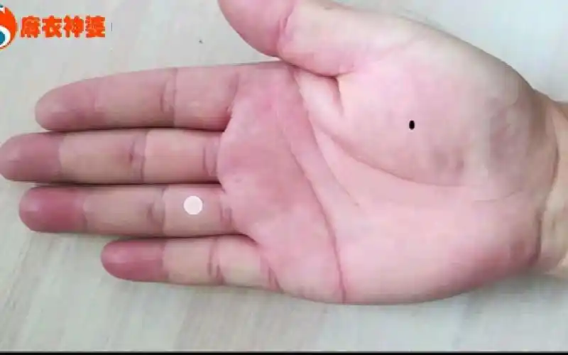 手掌金星丘有痣的人,事业基础好,能在父母的庇护下取得很好的成就