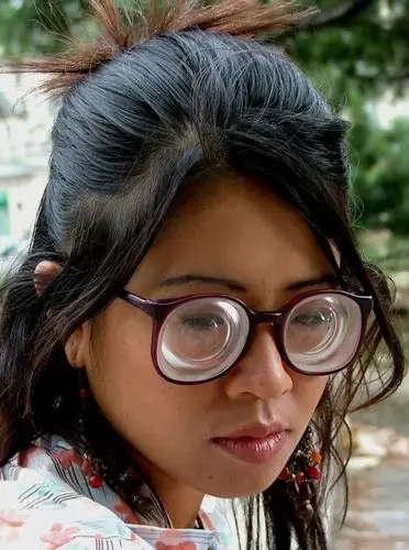 女主深度近视小说 高度近视保险