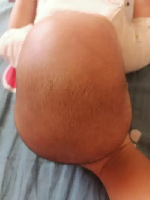 二胎听了月嫂的话一直侧睡,现在睡成了这样,耳后扁,有两个犄角,后脑勺