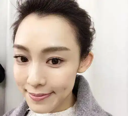 发际线对颜值的影响有多大?