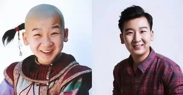好久不见的春晚童星:年少秃顶发福,相亲被嫌弃,因病去世留遗憾
