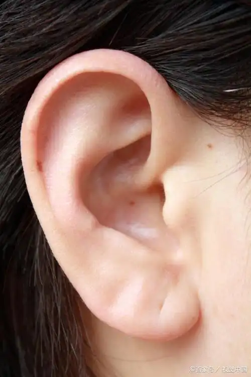 宝宝耳朵天生有小孔就是福气?父母别被忽悠了,这可不是闹着玩!