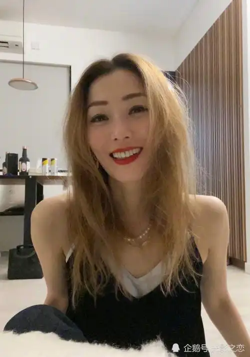 晒刮痧照吓坏粉丝,自拍照瘦得让人心疼,"颠覆"美形象的郑秀文