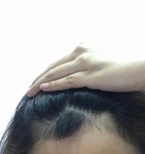 最近头顶突然张出一撮新头发是咋回事