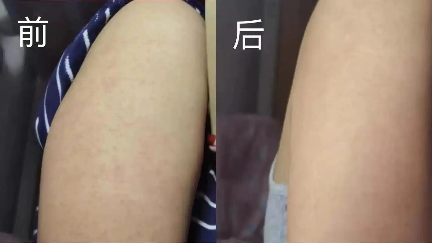 爆款美白身体乳修复各种皮肤粗糙暗沉,毛孔粗大,皮肤干燥,鸡皮 - 抖音