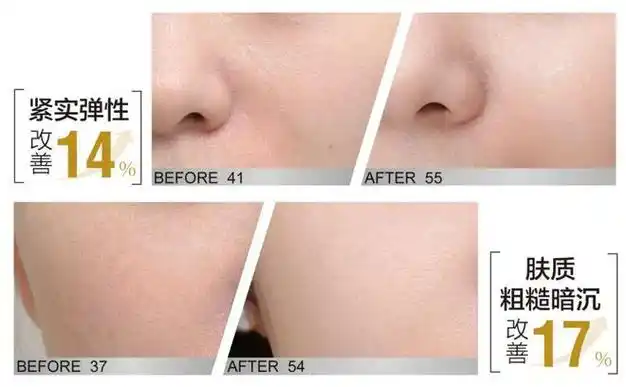 美肤驿站大声播报脆弱敏感肌有福了